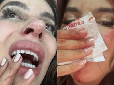 Influenciadora denuncia agressão por transfobia em bar no MA; polícia investiga motivação e desmente versão de agressora