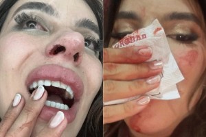 CASO LEA REIS: Da Violência Física ao Ódio Virtual: Polícia Divide Apuração Sobre Agressão a Influenciadora