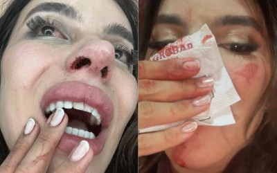 CASO LEA REIS: Da Violência Física ao Ódio Virtual: Polícia Divide Apuração Sobre Agressão a Influenciadora
