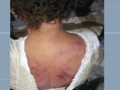 Mulher é agredida com golpes de punhal pelo ex-companheiro no MA