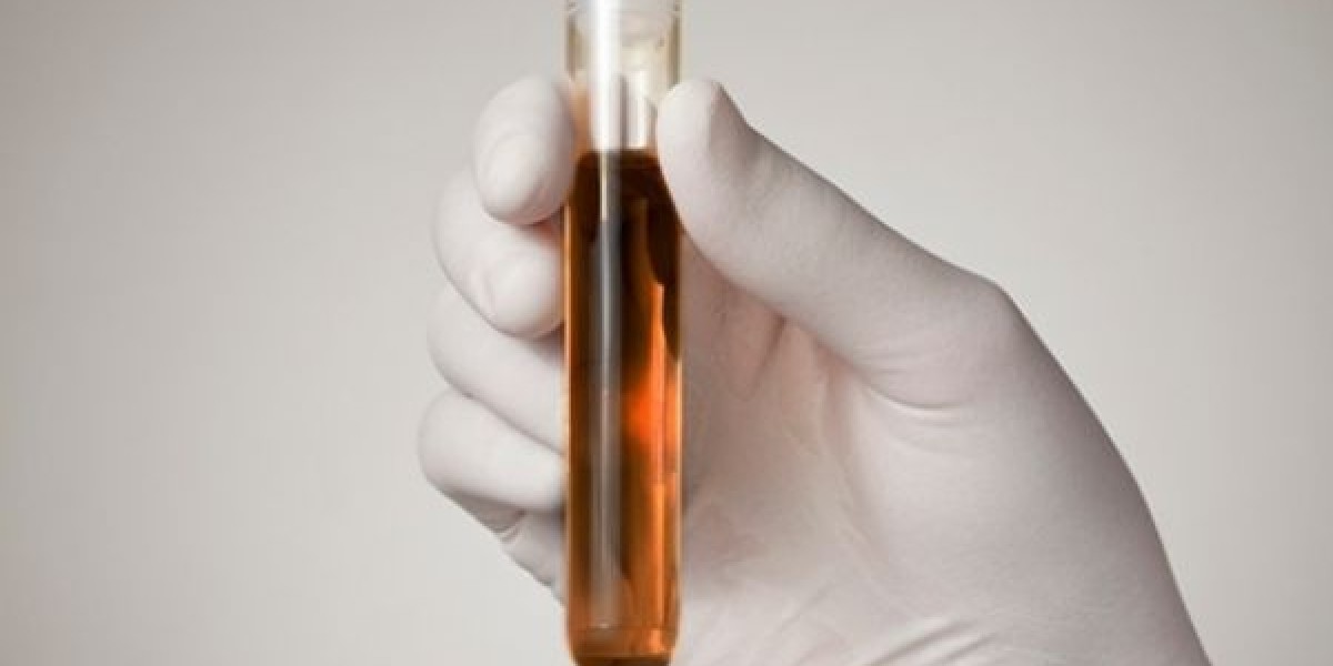 Caxias não registra casos da Síndrome de Haff