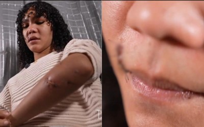 Violência em Rosário (MA): Polícia investiga tentativa de homicídio contra mulher trans agredida com garrafa