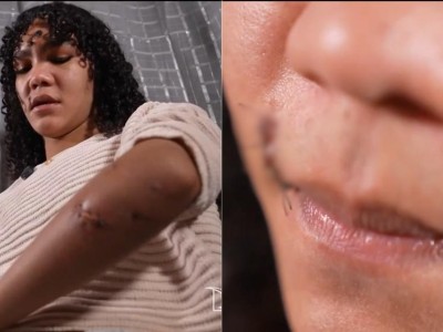 Violência em Rosário (MA): Polícia investiga tentativa de homicídio contra mulher trans agredida com garrafa