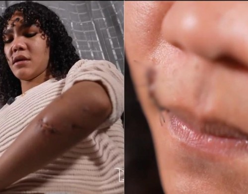 Violência em Rosário (MA): Polícia investiga tentativa de homicídio contra mulher trans agredida com garrafa