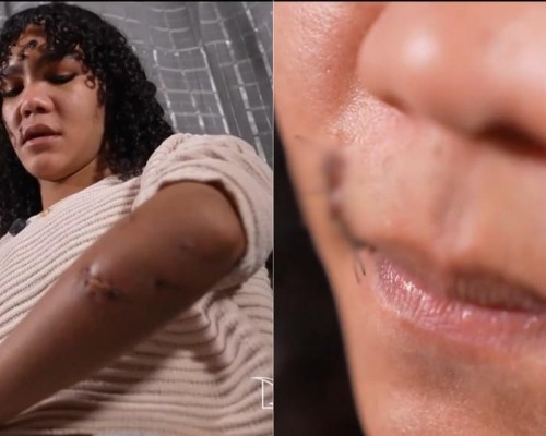 Violência em Rosário (MA): Polícia investiga tentativa de homicídio contra mulher trans agredida com garrafa