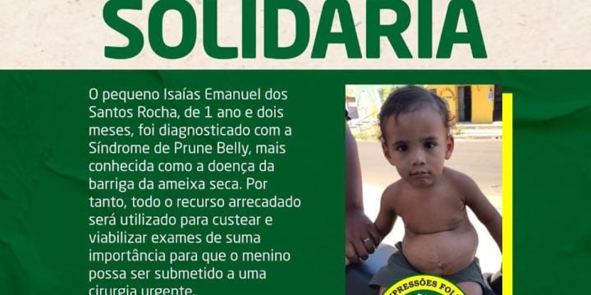 Dança do Lili de Caxias promove campanha solidária, para custear tratamento de criança com doença rara