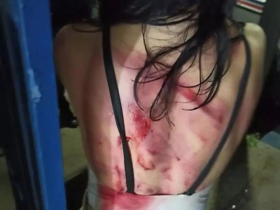 Jovem e brutalmente agredida com golpes de facão em Timbiras