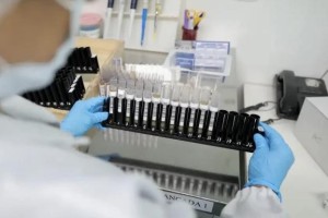 Vacina 100% brasileira contra malária avança para testes em humanos