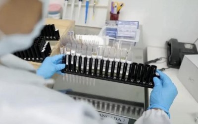 Vacina 100% brasileira contra malária avança para testes em humanos