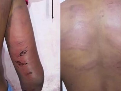  Policial é preso por suspeita de torturar adolescente em Pedreiras 