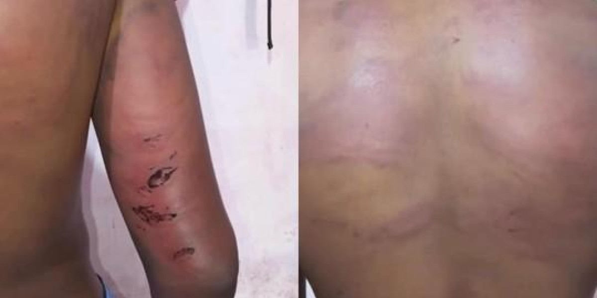  Policial é preso por suspeita de torturar adolescente em Pedreiras 