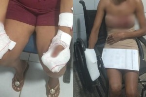 Homem é preso após atacar mãe e namorada com arma branca em Codó