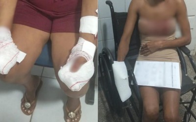 Homem é preso após atacar mãe e namorada com arma branca em Codó