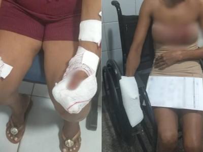 Homem é preso após atacar mãe e namorada com arma branca em Codó