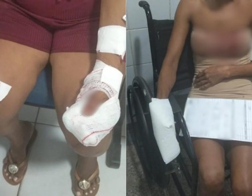 Homem é preso após atacar mãe e namorada com arma branca em Codó