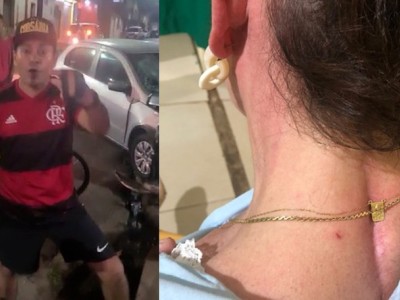 Policial civil flagrado agredindo advogada em Pinheiro é afastado das funções