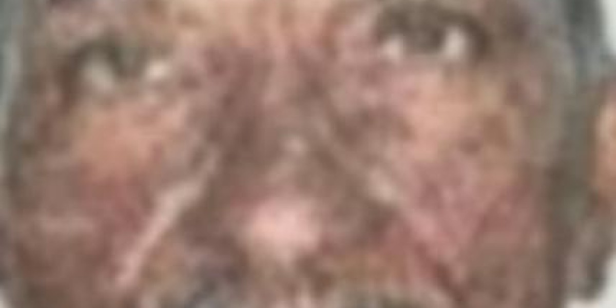 Idoso morre após ser atropelado por trem em Imperatriz