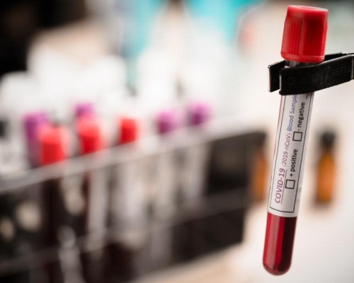Exame de sangue capaz de detectar mais de 50 tipos de câncer chega ao Brasil