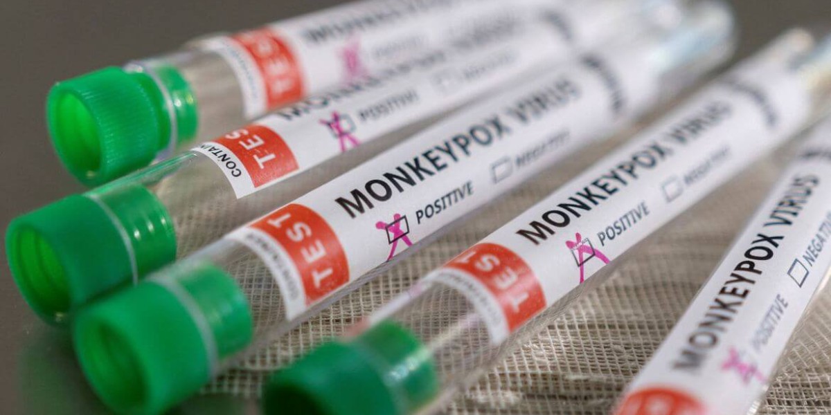 Maranhão tem mais nove casos suspeitos de varíola do macacos