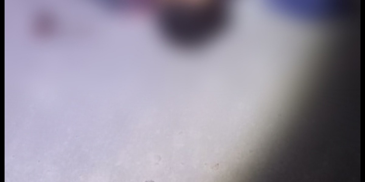 Homem é morto a tiros no bairro João Viana em Caxias 