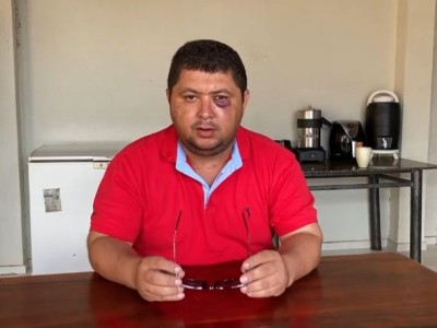 Vereador é agredido por professor após voto no aumento do salário da classe em Matões