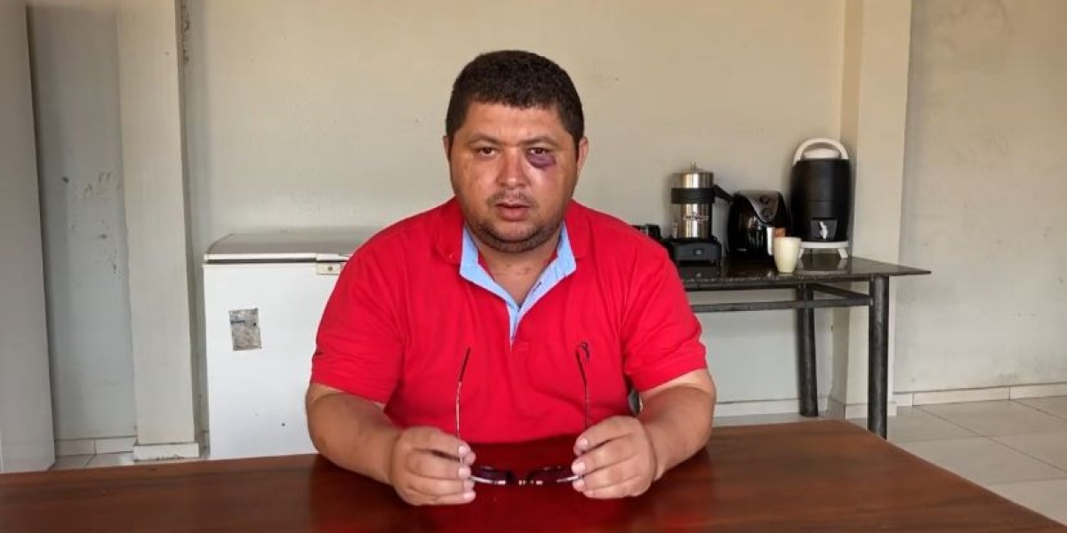 Vereador é agredido por professor após voto no aumento do salário da classe em Matões