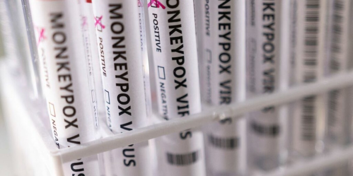 Anvisa recebe pedido de registro para teste de varíola dos macacos