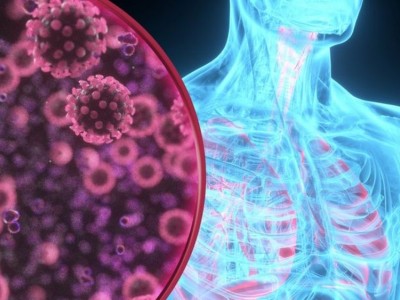 Mortes pela Covid-19 sobem para 415 em Caxias