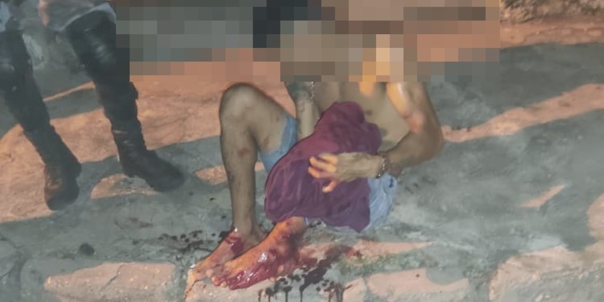 Suspeito é baleado após tentar assaltar pedestre em Caxias