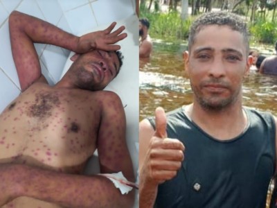 Homem morre após ataque de enxames de abelhas em Codó