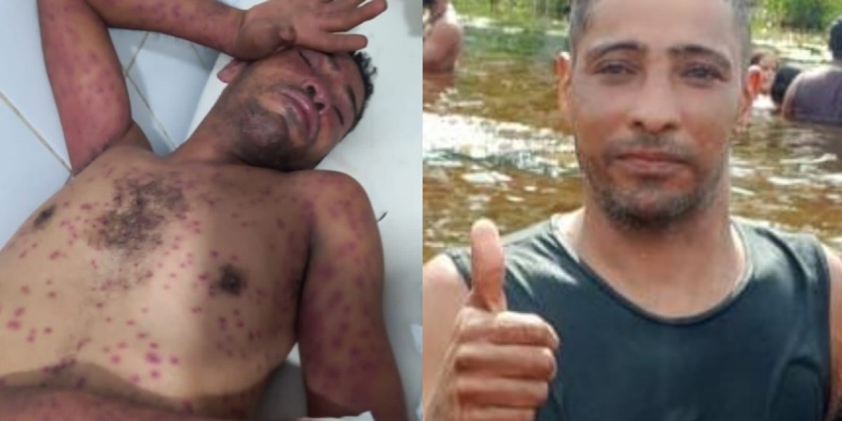 Homem morre após ataque de enxames de abelhas em Codó