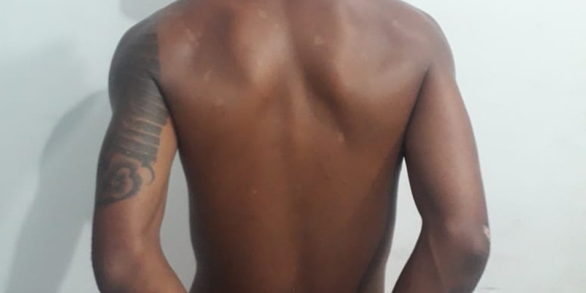 Polícia prende suspeito de agredir companheira a pauladas e pedradas no Maranhão