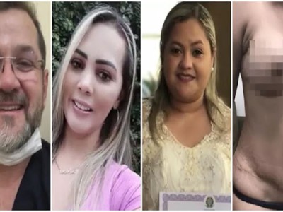 Duas mulheres morrem após realizar procedimentos estéticos em Imperatriz; cirurgião-plástico responde a vários processos por erro médico