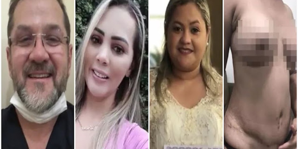 Duas mulheres morrem após realizar procedimentos estéticos em Imperatriz; cirurgião-plástico responde a vários processos por erro médico