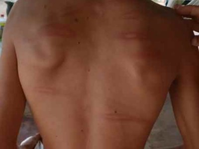 Homem é preso suspeito de torturar filho com deficiência intelectual, no Maranhão