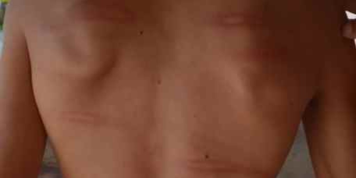 Homem é preso suspeito de torturar filho com deficiência intelectual, no Maranhão