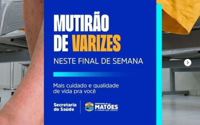 Prefeitura de Matões promove Mutirão de Varizes e amplia acesso da população a tratamentos de saúde