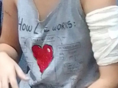 Jovem é esfaqueada mais de dez vezes pelo ex-namorado em Imperatriz