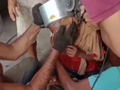 Criança fica com a cabeça presa em panela de pressão, em Coroatá