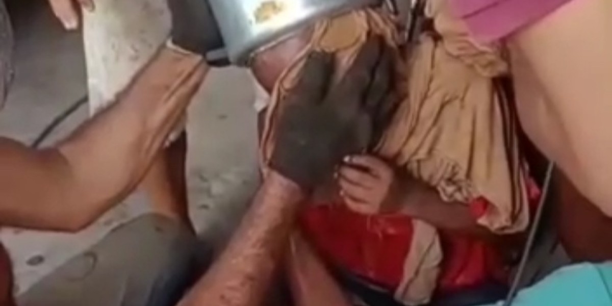 Criança fica com a cabeça presa em panela de pressão, em Coroatá