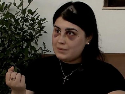 "Fiquei com o rosto deformado", desabafa mulher agredida por capitão da PM no Maranhão
