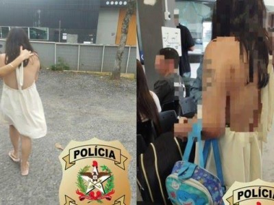 Madrasta é presa suspeita de queimar mão de enteada de 2 anos como forma de castigo em Santa Catarina 